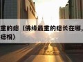 佛缘最重的痣（佛缘最重的痣长在哪,有佛缘之人的痣相）